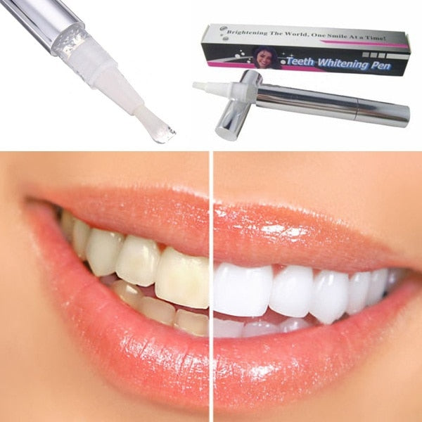 Popular White Teeth Whitening Pen Tooth Gel Whitener Bleach Remove - Sabuycar